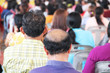 © somchai - Head lose hair.