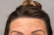 A closeup view on the eyebrows, forehead and hairline of a young Caucasian woman with brunette hair. Health, beauty and cosmetics concept.
