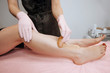© Smeilov - Close-up hands of cosmetologist in gloves applying paste for sugaring depilation on leg, hair removal beauty procedure.