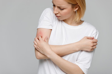 Close up of young woman scratching the itch on her hand, isolated on grey background. Dry skin, animal/food allergy, dermatitis, insect bites, irritation concept. 