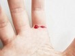 finger on right human hand was cut and bleeding with red blood from fresh wound
