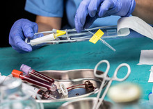 Nurse Prepares Venous Catheters Of Long Duration In A Hospital, Accessing Indwelling Central Venous Lines, Conceptual Image