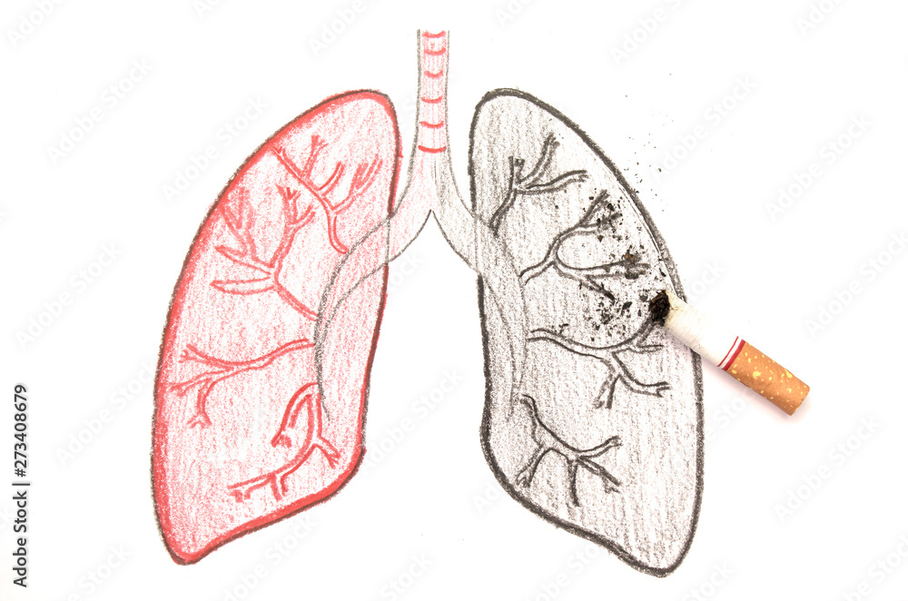 cigarette lung damage World No Tobacco Day; Smoking causes lung damage, isolated on white  background and space for text. Stock Photo