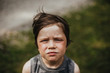 © Cavan Images - an unhappy boy has a bug bite on his eye
