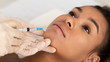 © Prostock-studio - Lip Augmentation. Afro Woman Receiving Hyaluronic Acid Injection