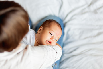 Wall Mural - Woman holding her child. Mother comforts her little son or daughter. Baby with a big birthmark on his or her forehead.