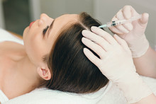 Treatment Of Hair Loss, Injection For Hair Growth. Injected In Woman's Head, Hair Mesotherapy