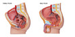 Plastic human body model with organs, urinary, pelvis part