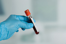 Doctor's Hand With Medical Glove Holding A Blood Probe In Front Of A Lab
