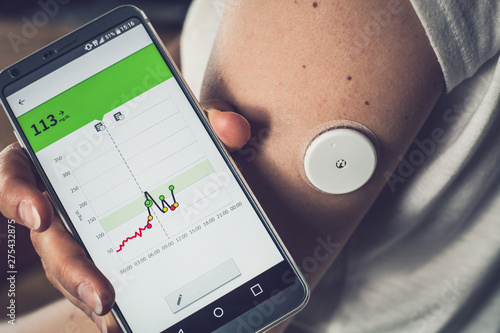 Fotografía Woman checking glucose level with a remote sensor and mobile phone, sensor checkup glucose levels without blood