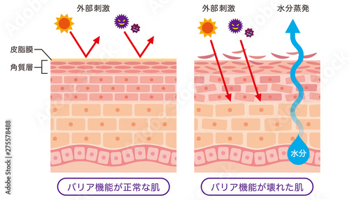 肌のバリア機能 皮膚構造 Stock イラスト Adobe Stock