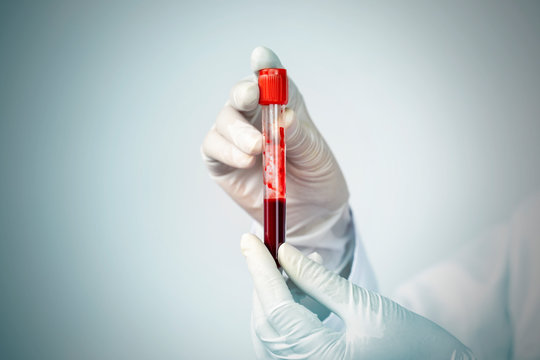 Doctor hand holding blood collection tubes in hematology laboratory, Medicine and science concept
