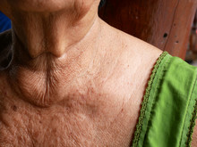 Close-up Skin Of An Elderly Woman.