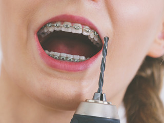 Wall Mural - Woman with braces using drill on her teeth