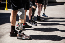 Unrecognizable Group Of Amputees Men Testing Their New Leg Prostheses