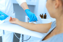 The Nurse Rubs The Hand With Alcohol Before Taking Blood From A Vein For Testing. Disinfects The Place Of Introduction Of A Needle With Antiseptic