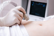Ultrasound scanner device in the hand of a professional doctor examining his patient doing abdominal ultrasound scanning early pregnancy for a young girl
