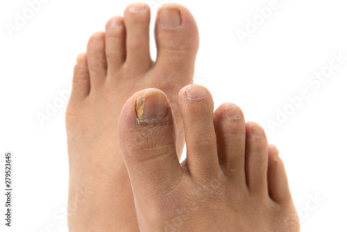 爪水虫 Stock Photo Adobe Stock