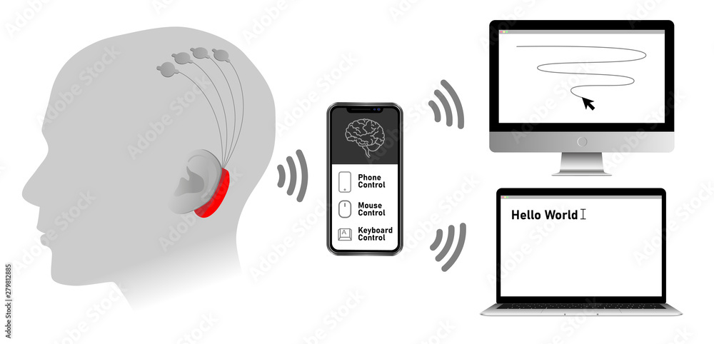 Implantable brain–machine interface with chronic electrode implant, neural-control interface, brain–computer interface. Communication between brain and external device. Neuroprosthetics
