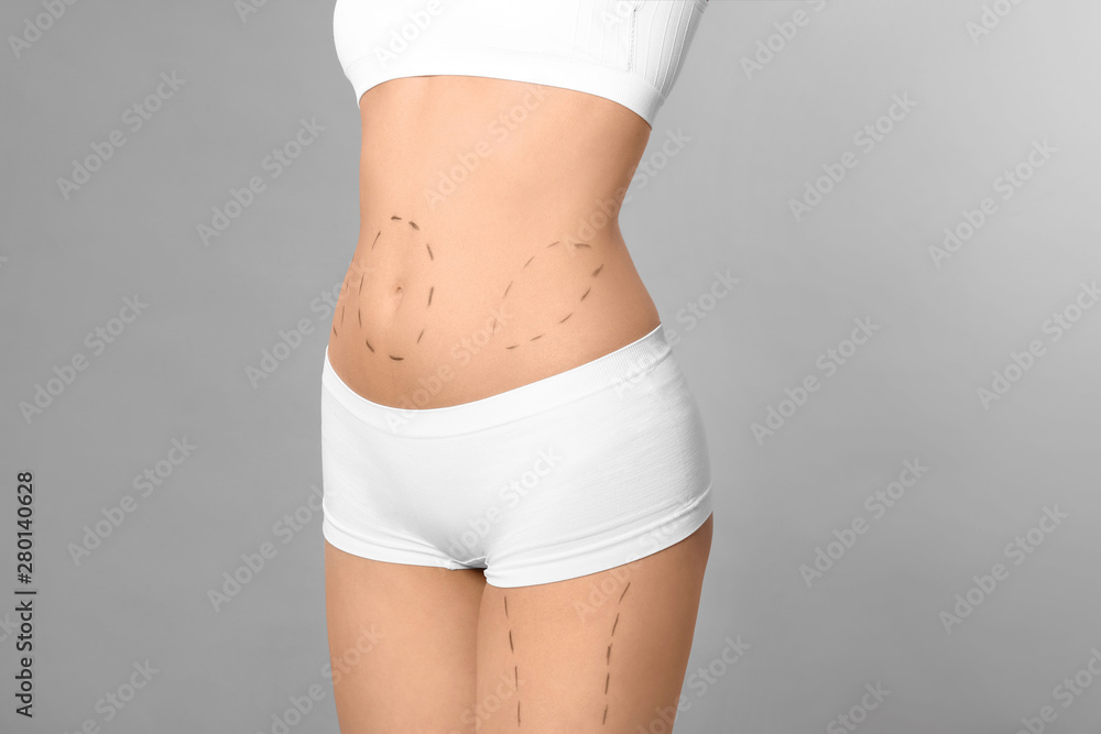 Young woman with marks on body for cosmetic surgery operation against grey background, closeup - obrazy, fototapety, plakaty 