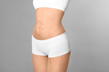 Young Woman With Marks On Body For Cosmetic Surgery Operation Against Grey Background, Closeup