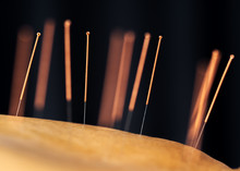 Close-up Of Senior Female Back With Steel Needles During Procedure Of Acupuncture Therapy
