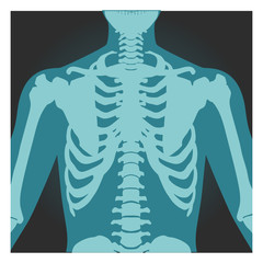 x-ray shot of shoulder, human body bones, radiography, rib cage, chest and arm, vector illustration.