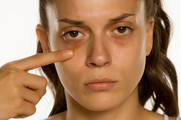 Young woman touching her low eyelids on yellow background