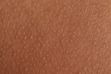 Poster - Dark brown human skin texture background