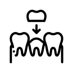 Poster - Stomatology Tooth Crown Vector Thin Line Sign Icon. Crown Dentist, Instrument Tool Equipment And Device Linear Pictogram. Medical Treatment Therapy Dentistry Monochrome Contour Illustration