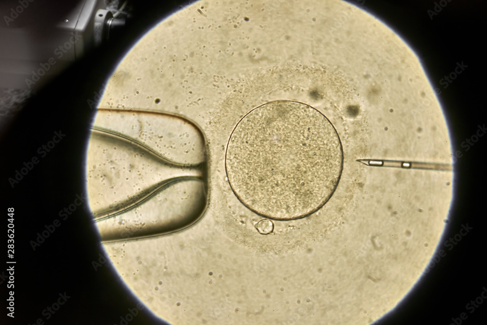 View through microscope at in vitro fertilization process Stock Photo ...
