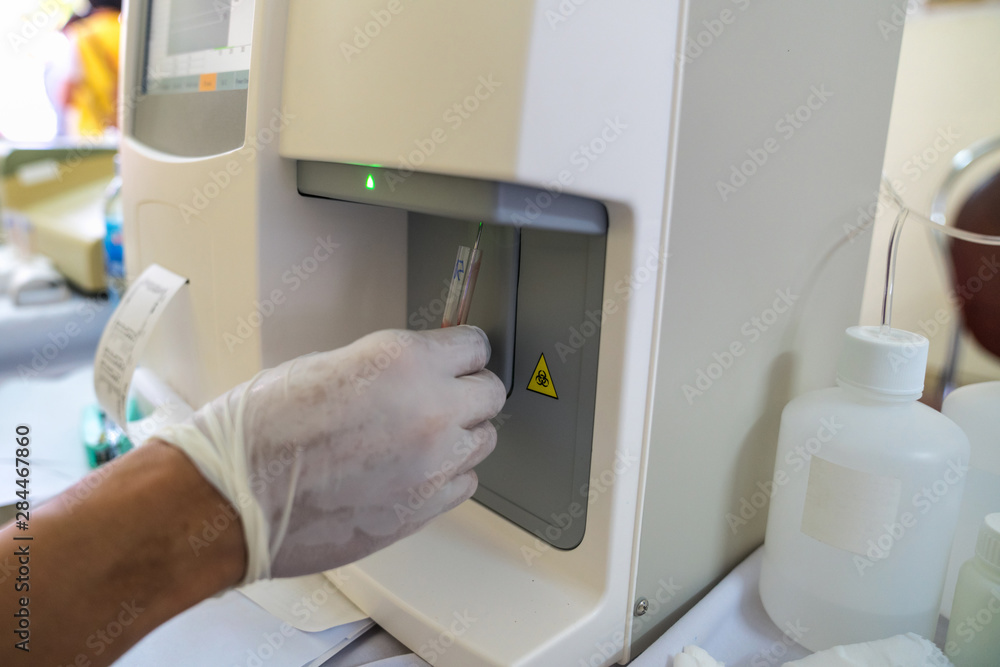 Doctor hand performing a blood test with hematological counter machine ...
