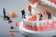 Dental Treatment Concept - Construction Workers Figurines On Tooth Model