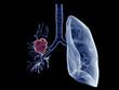 3d rendered medically accurate illustration of a lung tumor