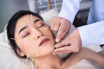 Sticker - woman undergoing acupuncture treatment on face