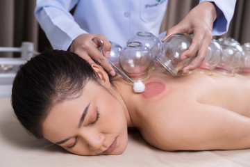 Sticker - woman receiving cupping treatment on back