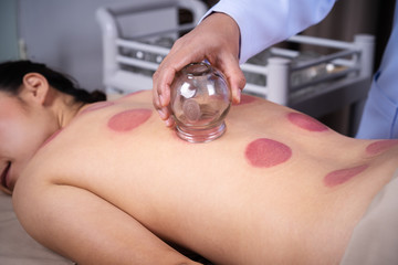 Canvas Print - woman receiving cupping treatment on back