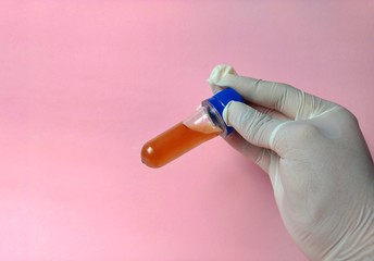 hand with white glove holding a laboratory sample on pink background. medical concept