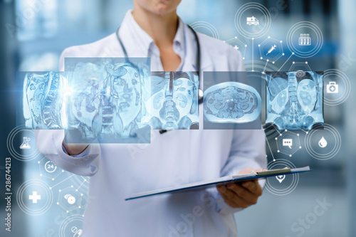 Cuadros en Lienzo Doctor examines of magnetic resonance imaging .