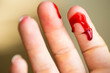 © annebel146 - Finger cut, bleeding injured with knife, Flesh blood wound in hand