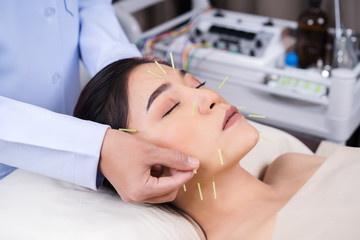 Wall Mural - woman undergoing acupuncture treatment on face