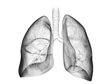 3d Rendered Medically Accurate Illustration Of The Lung