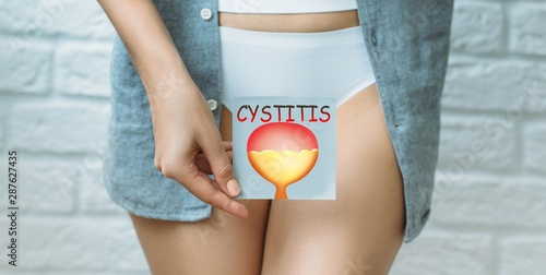 Fotomural woman suffering urinary system ache , bladder pain, cystitis