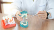 © Poj - Implant dental model in dental care concept.