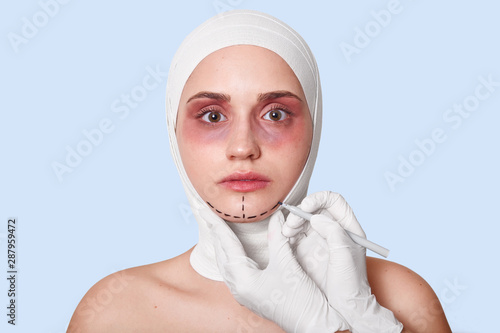 head wrapped in bandages