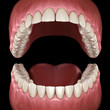 © Alex Mit - Dental anatomy - Opened Dentures. Medically accurate dental 3D illustration