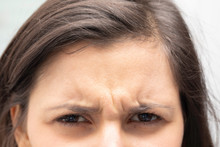 A Closeup View On The Frowning Forehead Of A Young Caucasian Girl With Brown Hair, With Dipped Eyebrows And Vertical Wrinkles, Unhappy Girl Close Up.