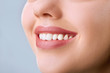 © verona_studio - Closeup of smile with white healthy teeth.Teeth whitening. Dental care. Lips care
