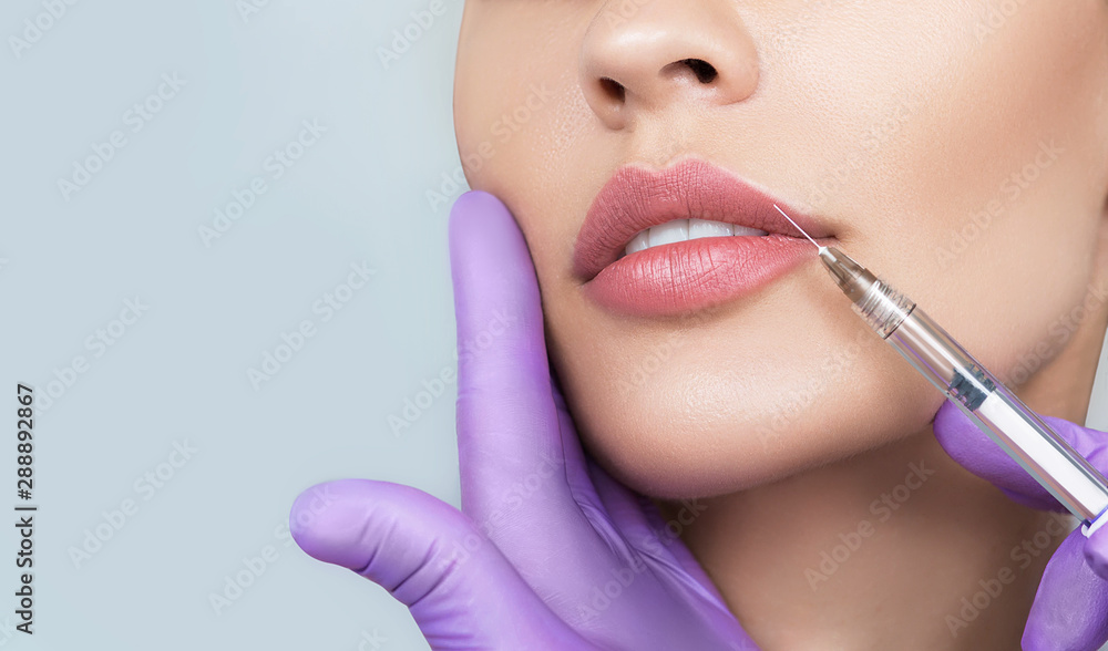 Cropped sensual female lips, procedure lip augmentation. Syringe near womans mouth, injections for increase lips shape - obrazy, fototapety, plakaty 