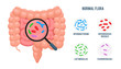 Realistic flat vector illustration:intestine, gut microflora infographic. Cartoon illustration isolated on white. Good flora: Bifidobacterium, Enterococcus Faecalis, Lactobacillus,Escherichia Coli